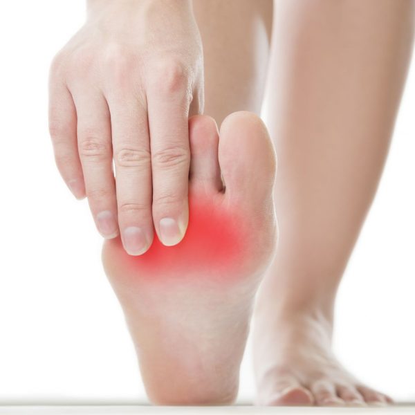 neuroma di morton neuroma di morton