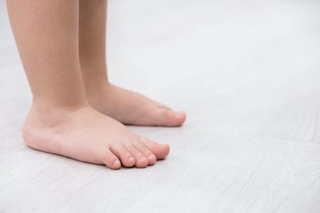 piede piatto del bambino 1